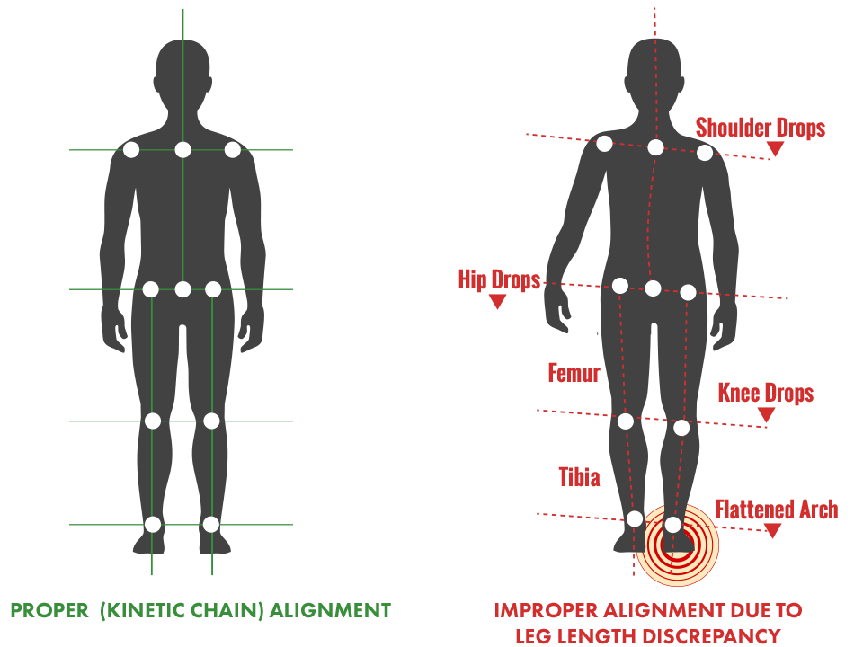 can-one-leg-shorter-than-the-other-cause-hip-pain-in-men